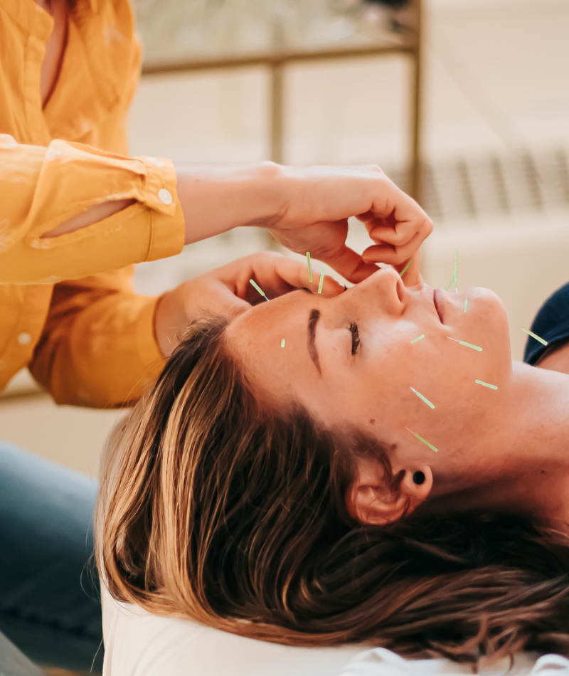 Patient relaxing during cosmetic acupuncture at Seneca Falls Acupuncture.