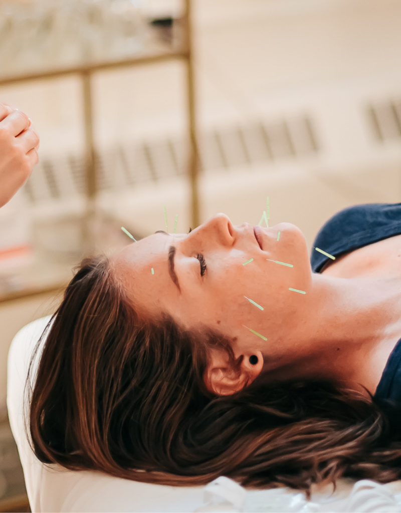 Patient resting during cosmetic acupuncture at Seneca Falls Acupuncture, NY.