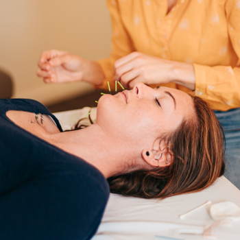 Woman relaxing while receiving cosmetic acupuncture treatment at Seneca Falls Acupuncture.