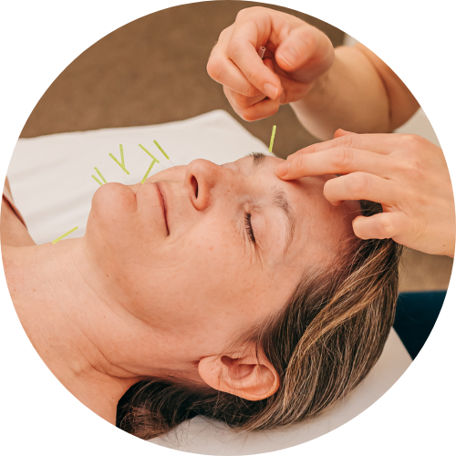 Female patient relaxing while getting cosmetic acupuncture to naturally reduce fine lines, wrinkles, and dark under-eye circles at Seneca Falls Acupuncture in the Finger Lakes, NY.