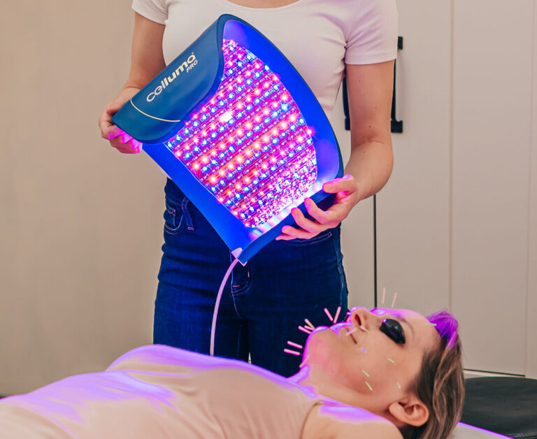 Celluma LED Light Lamp being placed over a patient's face during cosmetic acupuncture treatment at Seneca Falls Acupuncture.