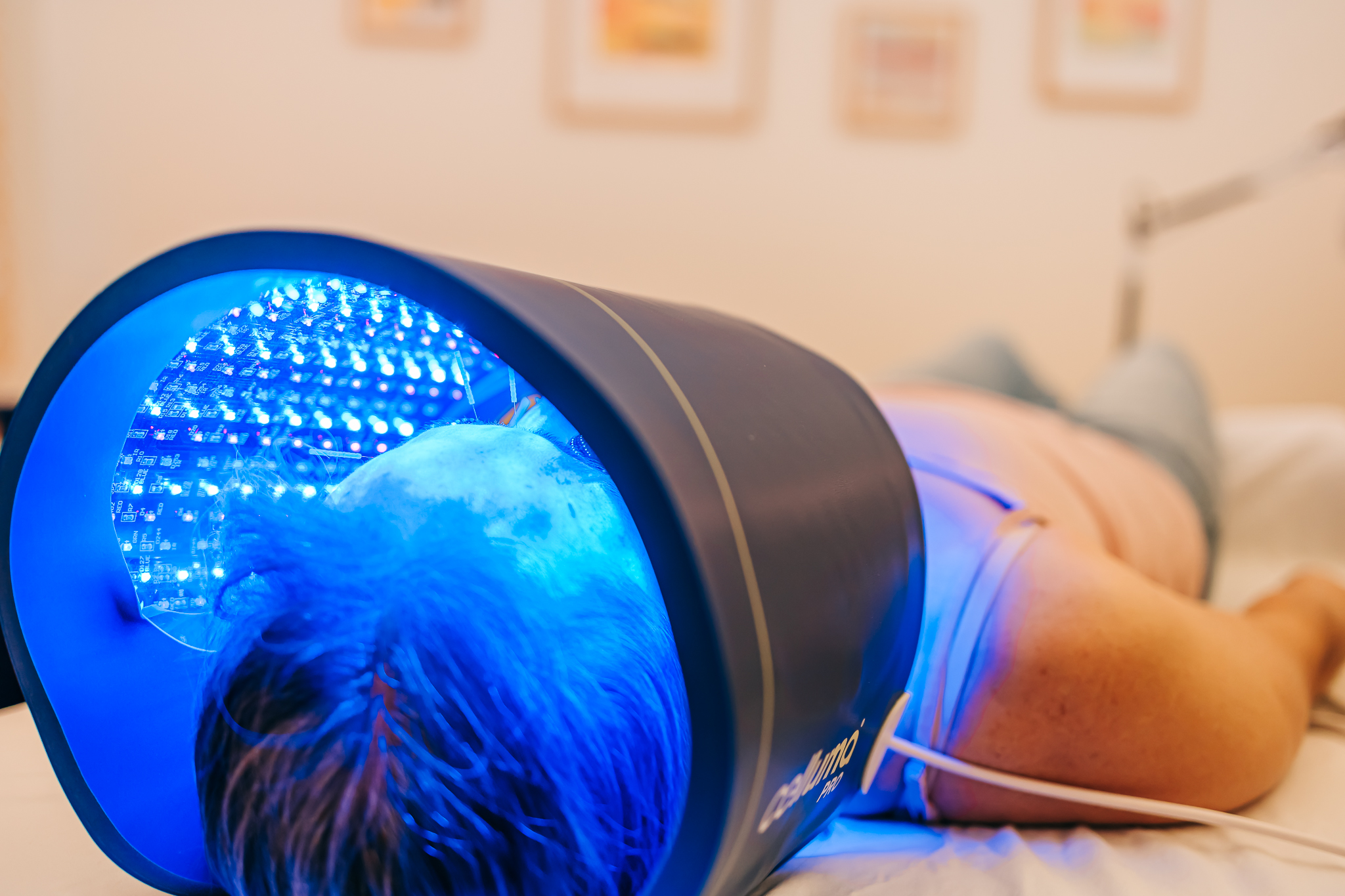 Patient resting during a cosmetic acupuncture treatment with Celluma LED Light therapy add-on at Seneca Falls Acupuncture.