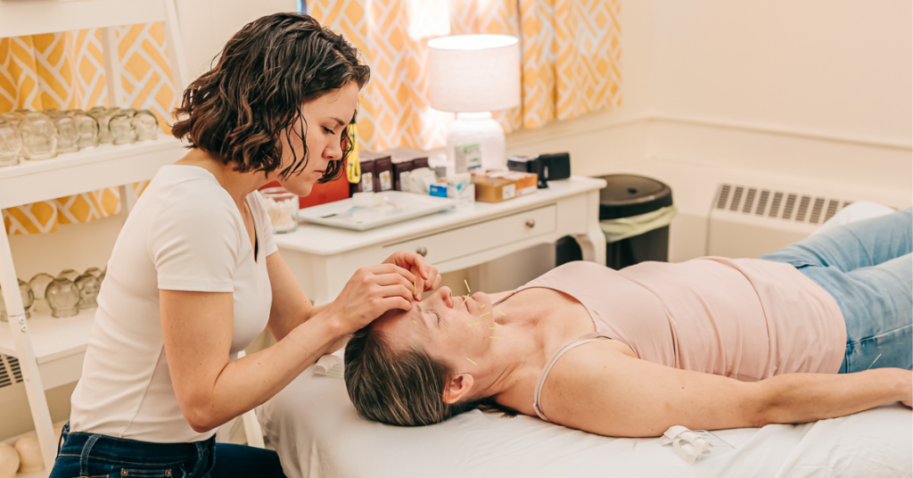 Patient napping during a cosmetic acupuncture treatment for wrinkles between the brows at Seneca Falls Acupuncture.