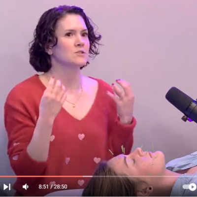 Acupuncturist Michelle Grasek of Seneca Falls Acupuncture performing cosmetic acupuncture on a patient during a livestream broadcast in the Finger Lakes 1 podcast studio.