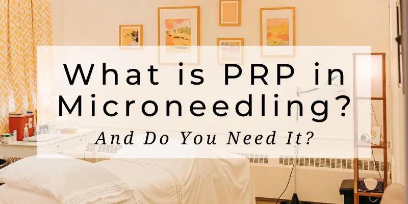 What is PRP in Microneedling and Do You Really Need It?