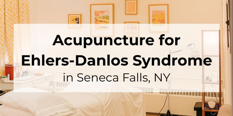 Acupuncture for Ehlers-Danlos Syndrome symptoms in Seneca Falls, NY
