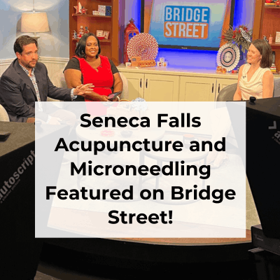 Seneca Falls Acupuncture is thrilled to be featured on Syracuse's News Channel 9 Bridge Street Show for the third time! This week we discussed the wrinkle-reducing benefits of microneedling