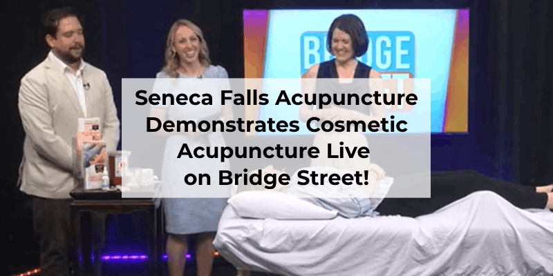 Image of acupuncturist Michelle Grasek speaking with Bridge Street hosts on set while volunteer rests with acupuncture on a treatment table in front of them.
