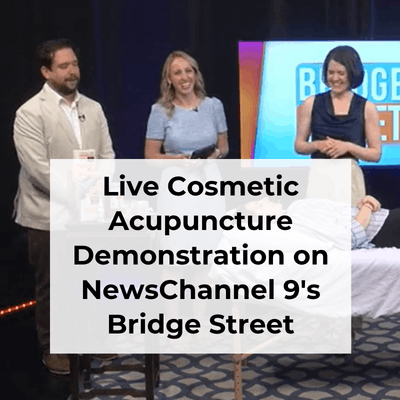 Image of acupuncturist Michelle Grasek speaking with Bridge Street hosts on set while volunteer rests with acupuncture on a treatment table in front of them.