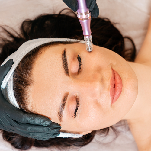 Microneedling, also called collagen induction therapy, in Seneca Falls, New York. Proudly serving the Skaneateles, Auburn, Canandaigua and greater Finger Lakes region.